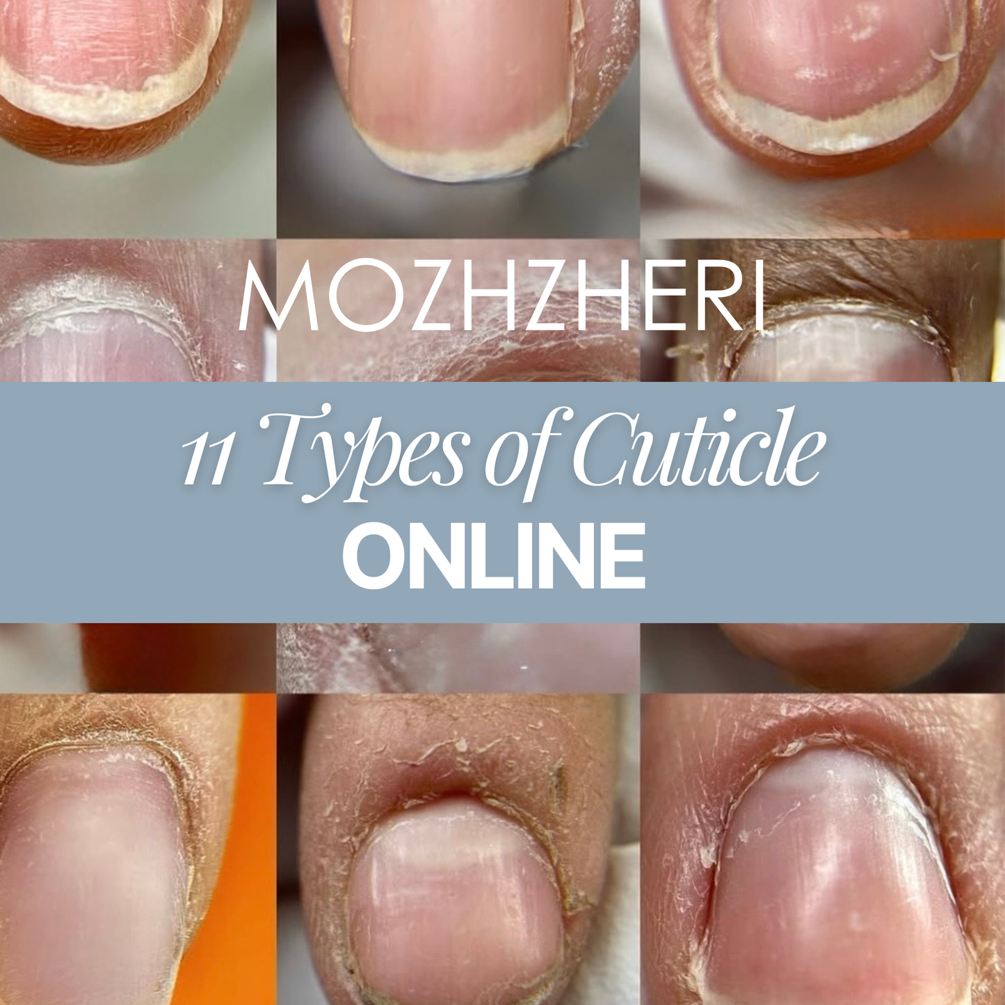 MOZHZHERI 11 Types of Cuticle Online
